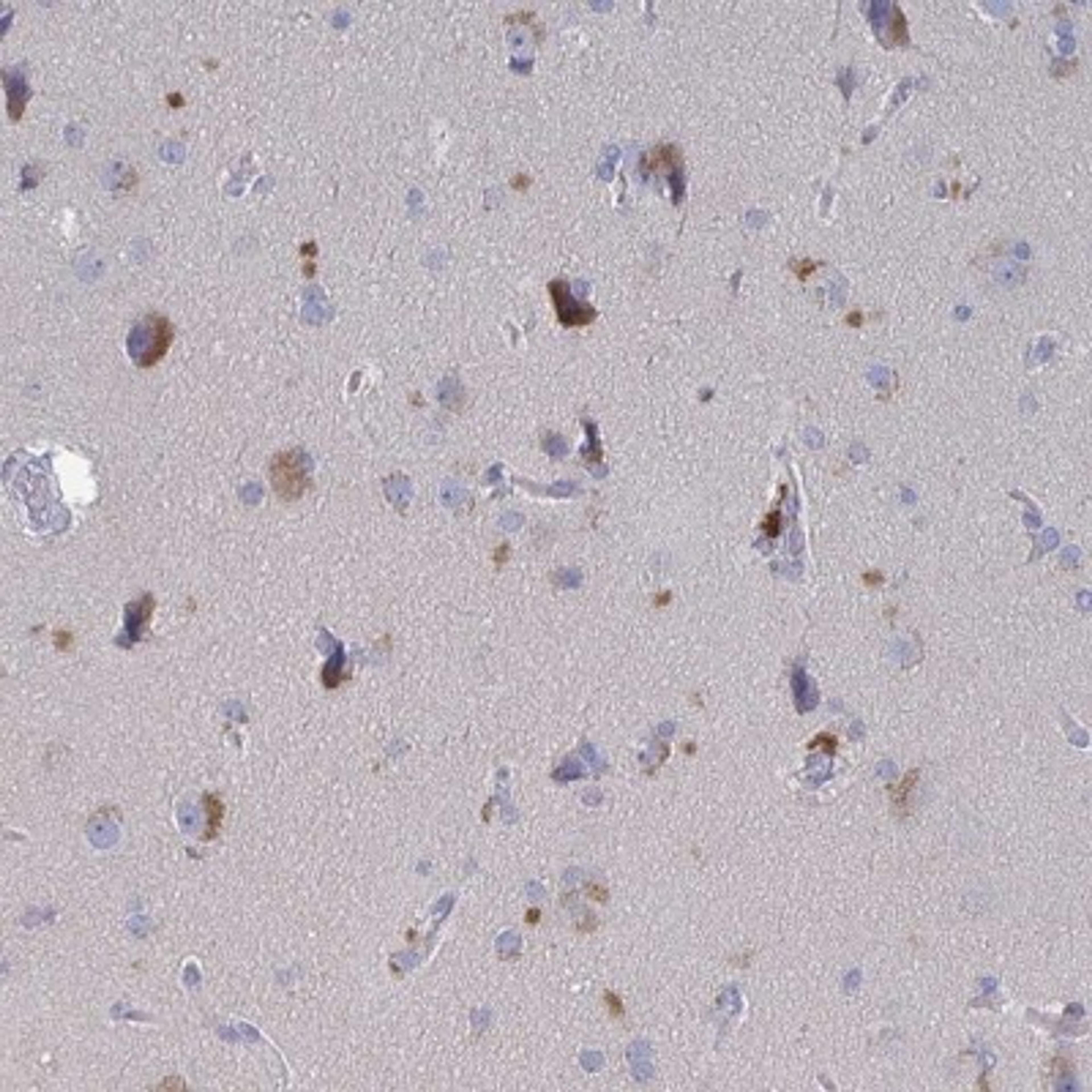 Immunohistochemistry: GPR148 Antibody [NBP2-32550] - Staining of human cerebral cortex shows strong cytoplasmic positivity in neuronal cells.