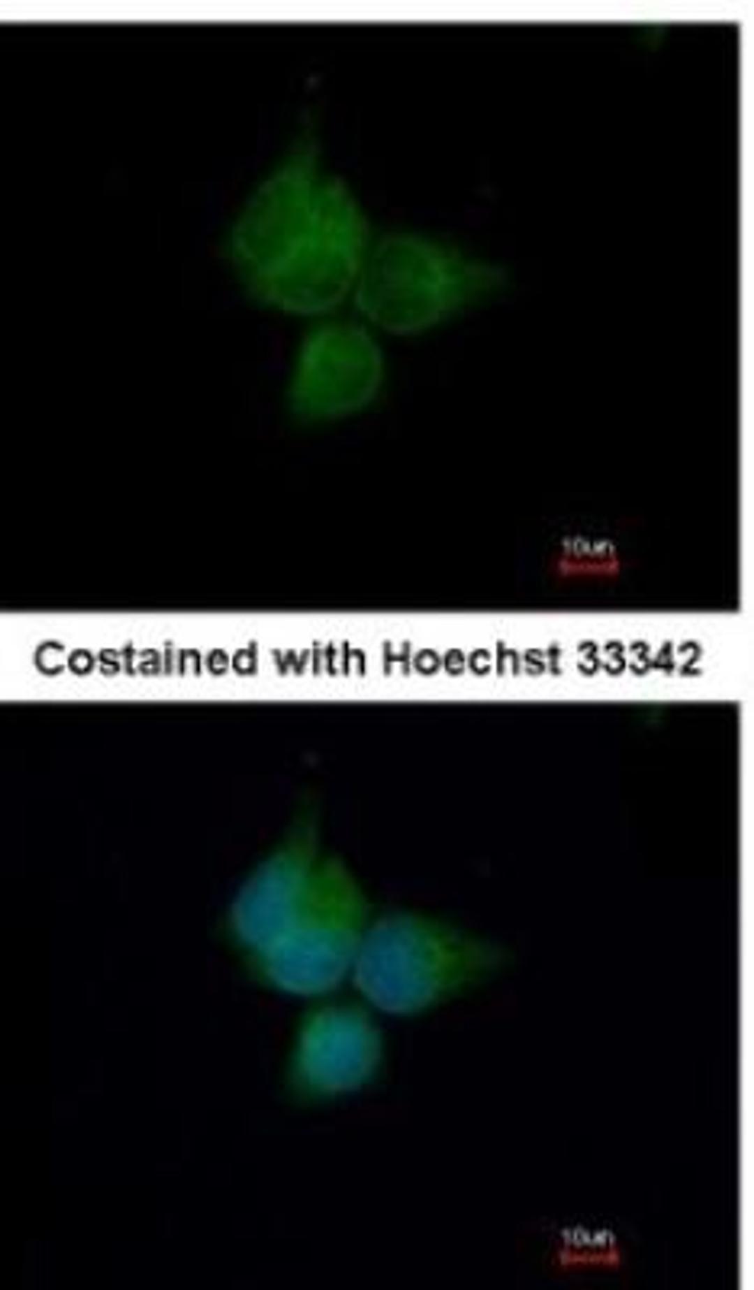 Immunocytochemistry/Immunofluorescence: ATP6V1A Antibody [NBP1-33021] - Analysis of methanol-fixed A431, using antibody at 1:500 dilution.