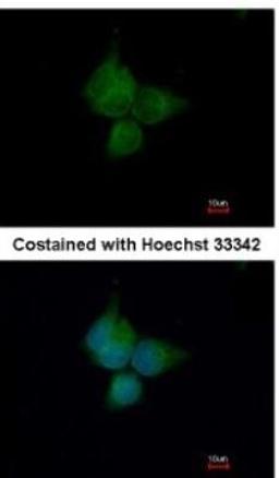 Immunocytochemistry/Immunofluorescence: ATP6V1A Antibody [NBP1-33021] - Analysis of methanol-fixed A431, using antibody at 1:500 dilution.