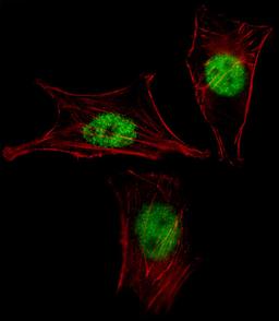 Fluorescent image of NIH-3T3 cell stained with MEOX2 Antibody .NIH-3T3 cells were fixed with 4% PFA (20 min), permeabilized with Triton X-100 (0.1%, 10 min), then incubated with MEOX2 primary antibody (1:25). For secondary antibody, Alexa Fluor 488 conjug