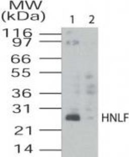 Western Blot: TMED4 Antibody [NB100-56393] - HL60 cell lysates Lane 1: Unabsorbed NB100-56393 Lane 2: Blocked with immunizing peptide