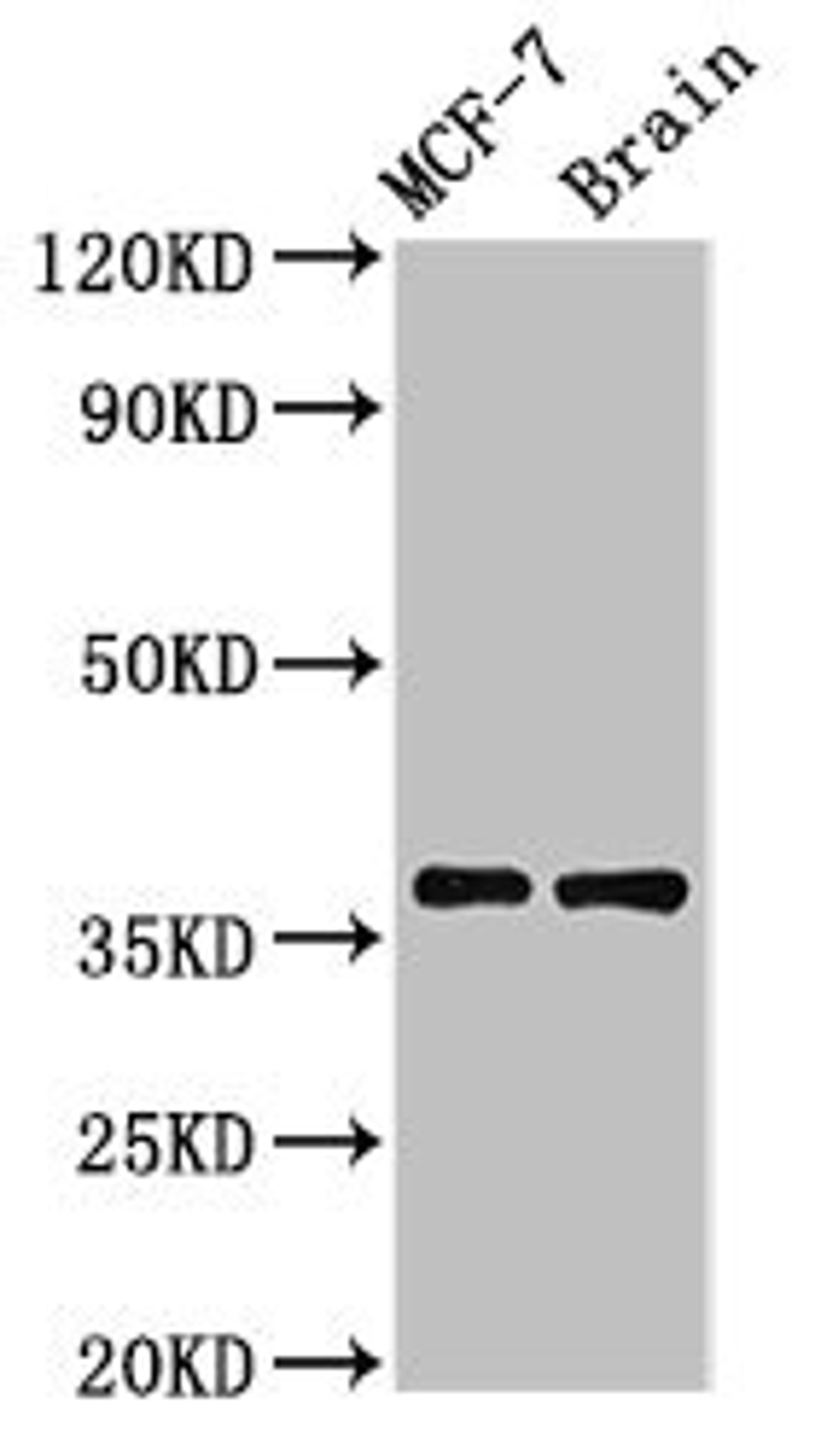 Western Blot. Positive WB detected in: MCF-7 whole cell lysate, Rat brain tissue. All lanes: MENT antibody at 3.2µg/ml. Secondary. Goat polyclonal to rabbit IgG at 1/50000 dilution. Predicted band size: 37, 19 kDa. Observed band size: 37 kDa