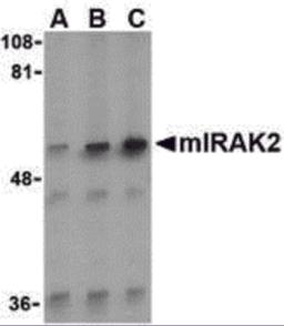 Western blot analysis of IRAK2 in A-20 whole cell lysate with IRAK2 antibody (C2) at (A) 0.5, (B) 1, and (C) 2 &#956;g/mL.