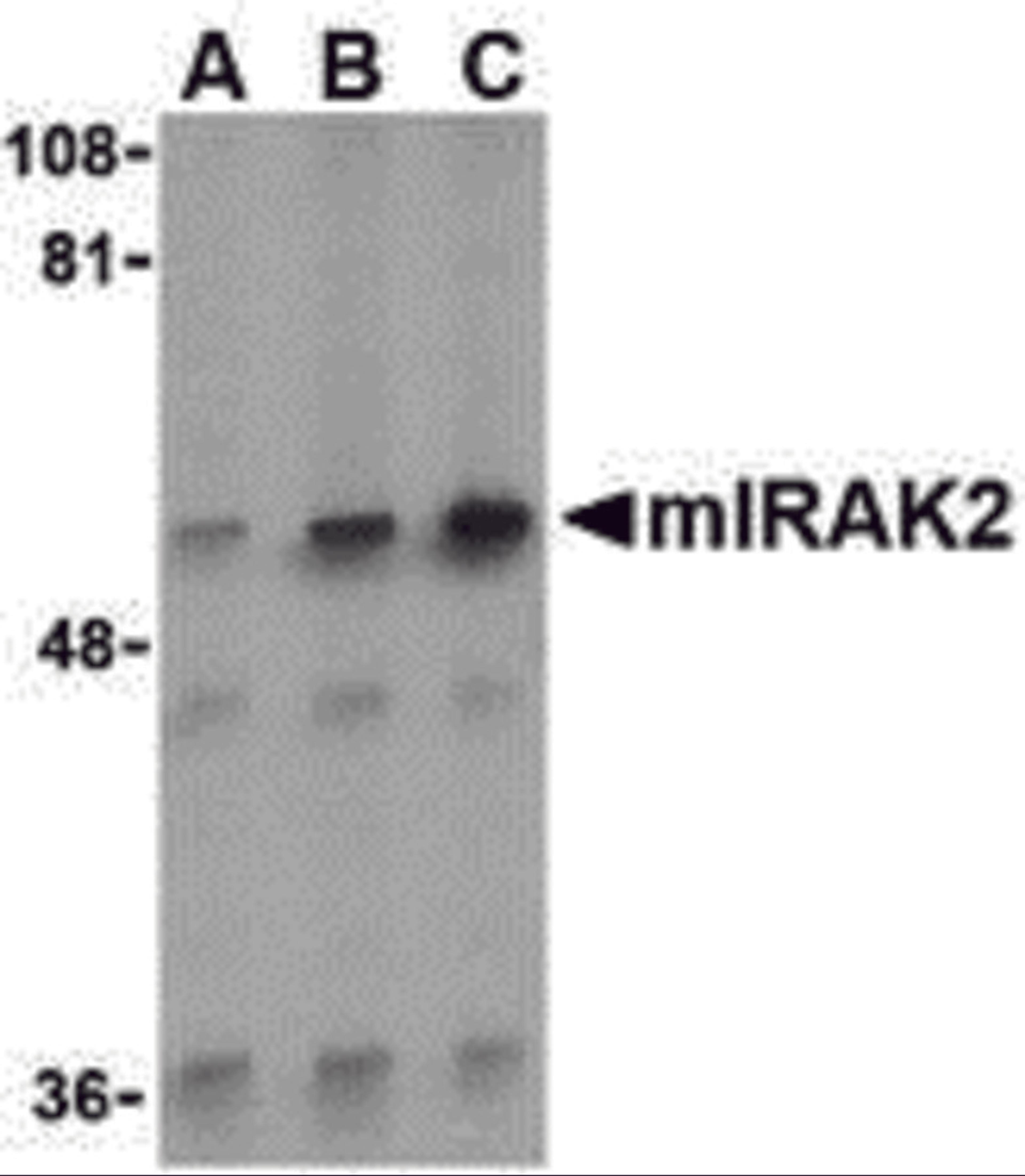 Western blot analysis of IRAK2 in A-20 whole cell lysate with IRAK2 antibody (C2) at (A) 0.5, (B) 1, and (C) 2 &#956;g/mL.