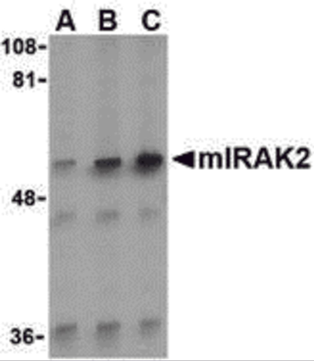 Western blot analysis of IRAK2 in A-20 whole cell lysate with IRAK2 antibody (C2) at (A) 0.5, (B) 1, and (C) 2 μg/mL.