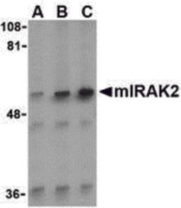 Western blot analysis of IRAK2 in A-20 whole cell lysate with IRAK2 antibody (C2) at (A) 0.5, (B) 1, and (C) 2 μg/mL.