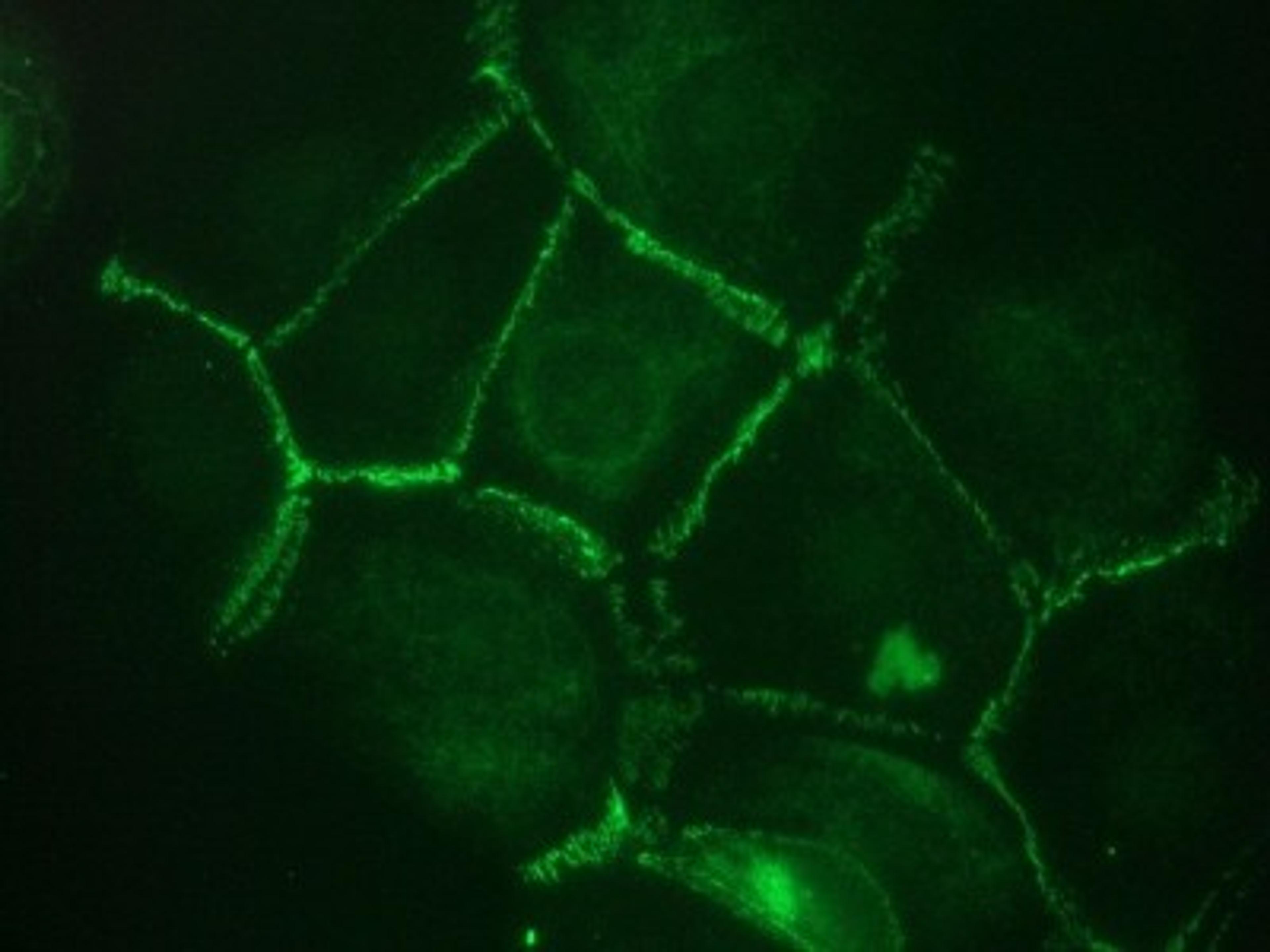 Immunocytochemistry/Immunofluorescence: Cadherin-11 Antibody (16A) [NBP1-97676] - Immunocytochemistry on Cadherin 11 transfected PC3 cells