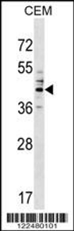 Western blot analysis in CEM cell line lysates (35ug/lane).