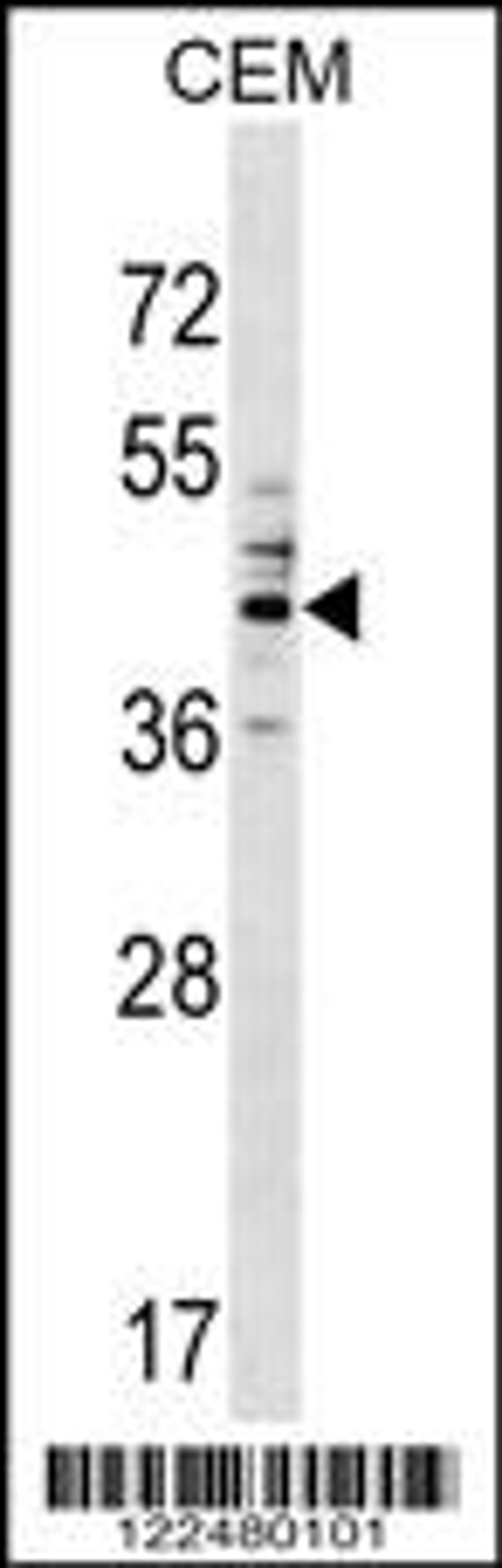 Western blot analysis in CEM cell line lysates (35ug/lane).