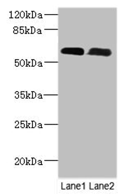 Western Blot. All lanes: PNPLA1 antibody at 12ug/ml. Lane 1: Mouse spleen tissue. Lane 2: Mouse skeletal muscle tissue. Secondary. Goat polyclonal to rabbit IgG at 1/10000 dilution. Predicted band size: 58, 48, 49 kDa. Observed band size: 58 kDa. 