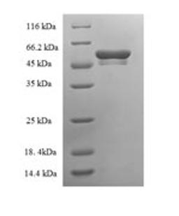 (Tris-Glycine gel) Discontinuous SDS-PAGE (reduced) with 5% enrichment gel and 15% separation gel.