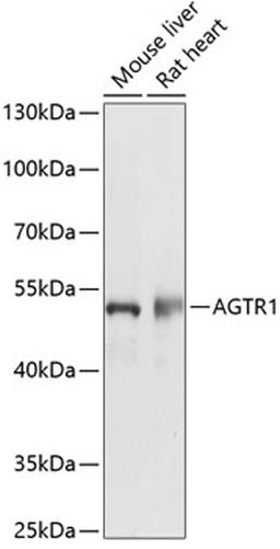 Western blot - AGTR1 antibody (A14201)