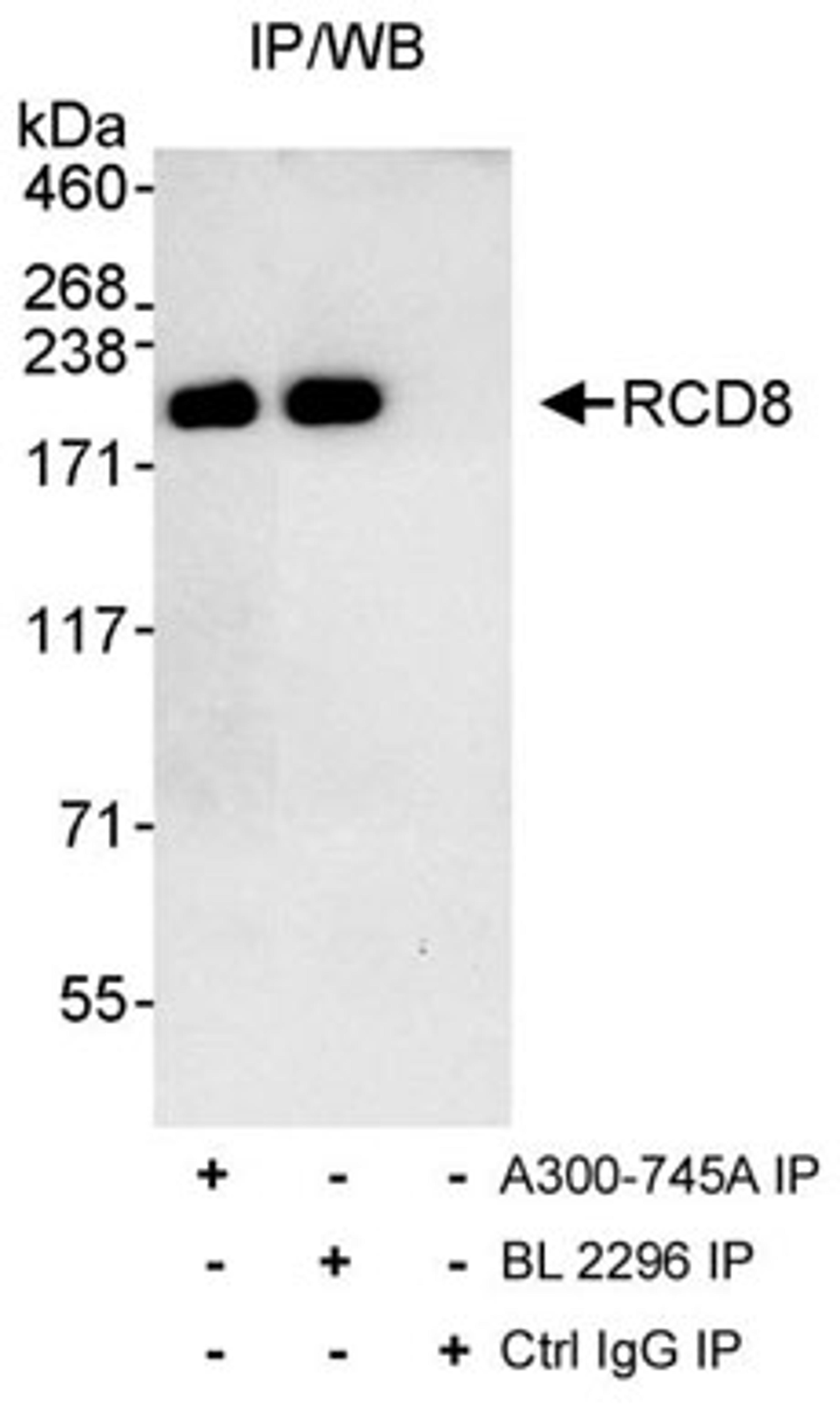 Detection of human RCD8 by western blot of immunoprecipitates.