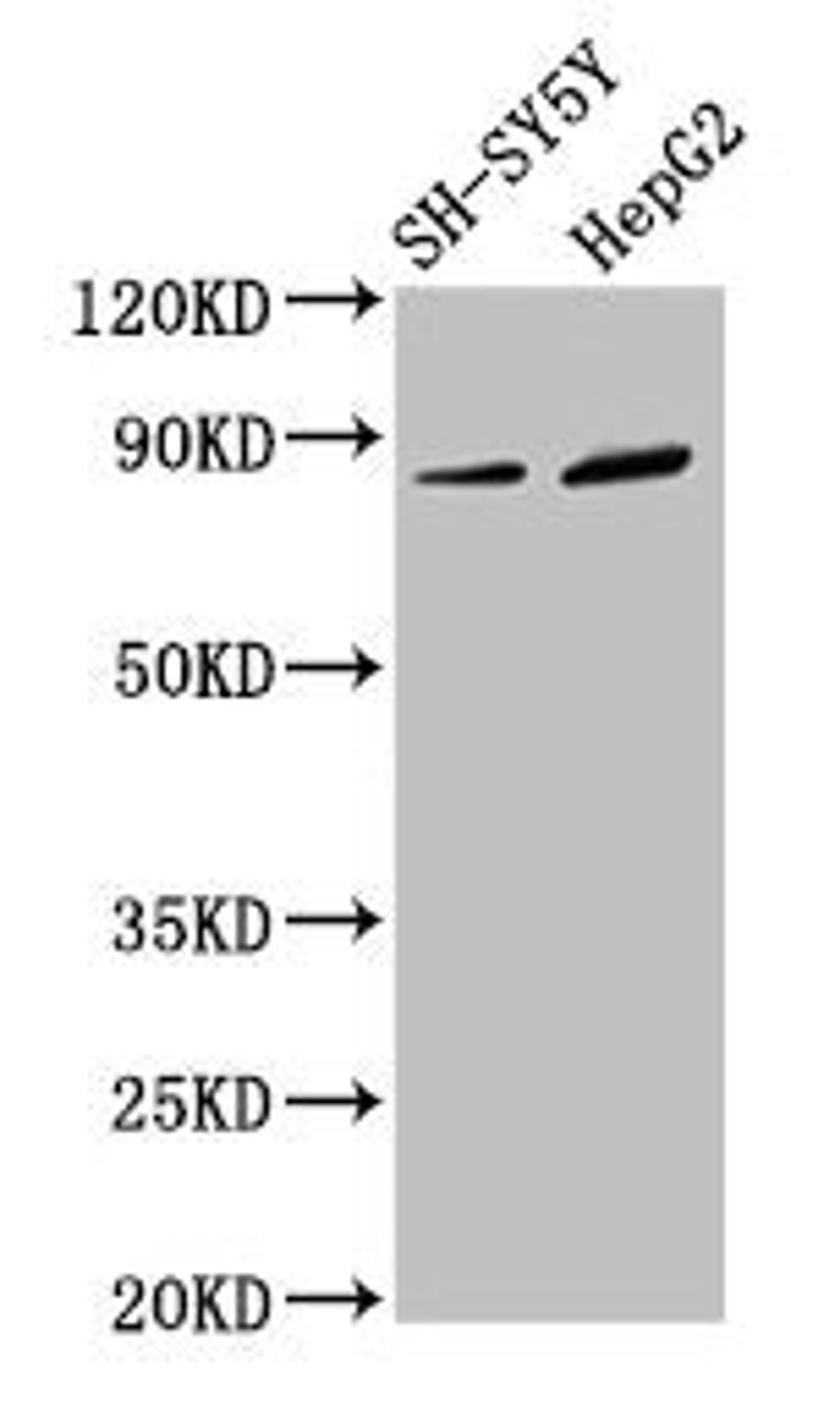 Western Blot. Positive WB detected in: SH-SY5Y whole cell lysate, HepG2 whole cell lysate. All lanes: DPY19L3 antibody at 3.4µg/ml. Secondary. Goat polyclonal to rabbit IgG at 1/50000 dilution. Predicted band size: 84, 63 kDa. Observed band size: 84 kDa