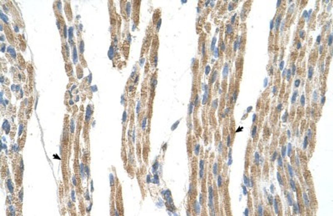 Immunohistochemistry-Paraffin: GPT Antibody [NBP1-53177] - Human Muscle Tissue, Skeletal muscle cells (Indicated with Arrows) 4-8ug/ml.