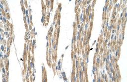 Immunohistochemistry-Paraffin: GPT Antibody [NBP1-53177] - Human Muscle Tissue, Skeletal muscle cells (Indicated with Arrows) 4-8ug/ml.