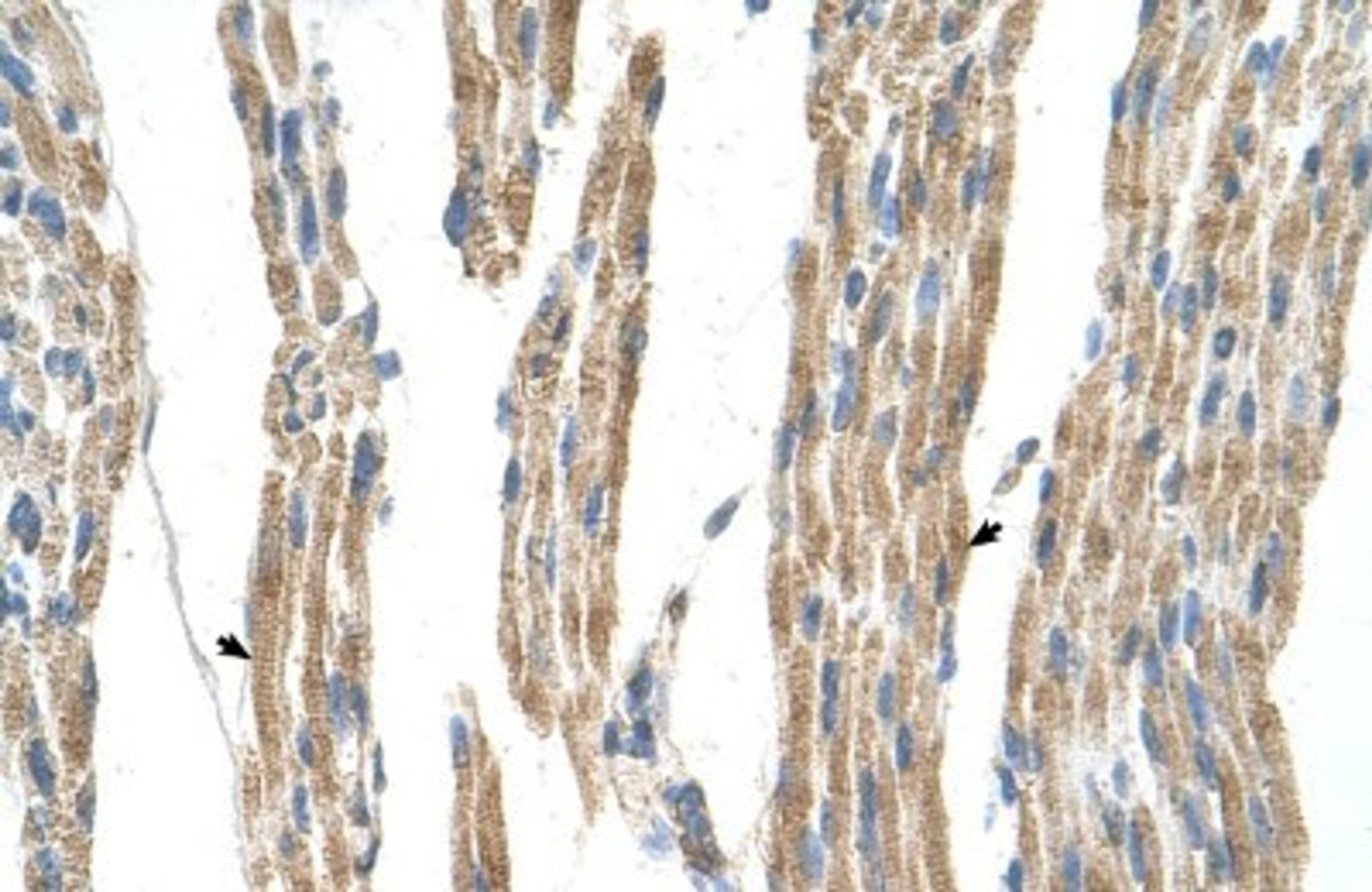 Immunohistochemistry-Paraffin: GPT Antibody [NBP1-53177] - Human Muscle Tissue, Skeletal muscle cells (Indicated with Arrows) 4-8ug/ml.