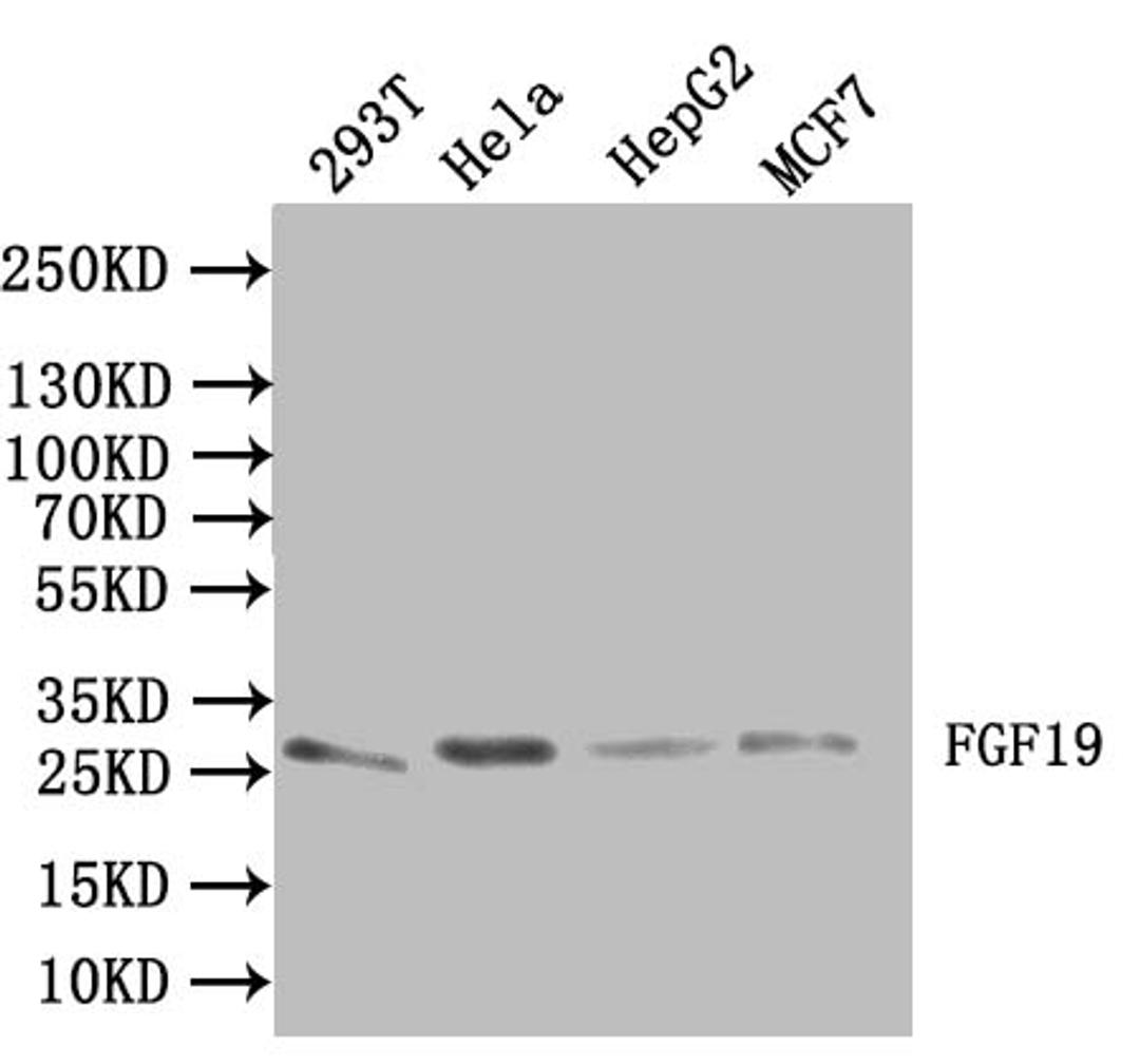 Western blot. All lanes: FGF19 antibody IgG at 3.26ug/ml + Mouse brain tissue. Secondary. Goat polyclonal to rabbit IgG at 1/10000 dilution. Predicted band size: 24 kDa. Observed band size: 24 kDa.
