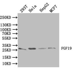 Western blot. All lanes: FGF19 antibody IgG at 3.26ug/ml + Mouse brain tissue. Secondary. Goat polyclonal to rabbit IgG at 1/10000 dilution. Predicted band size: 24 kDa. Observed band size: 24 kDa.