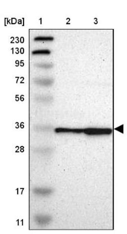 Western Blot: Tsukushin Antibody [NBP1-87959] - Lane 1: Marker [kDa] 230, 130, 95, 72, 56, 36, 28, 17, 11<br/>Lane 2: Human cell line RT-4<br/>Lane 3: Human cell line U-251MG sp