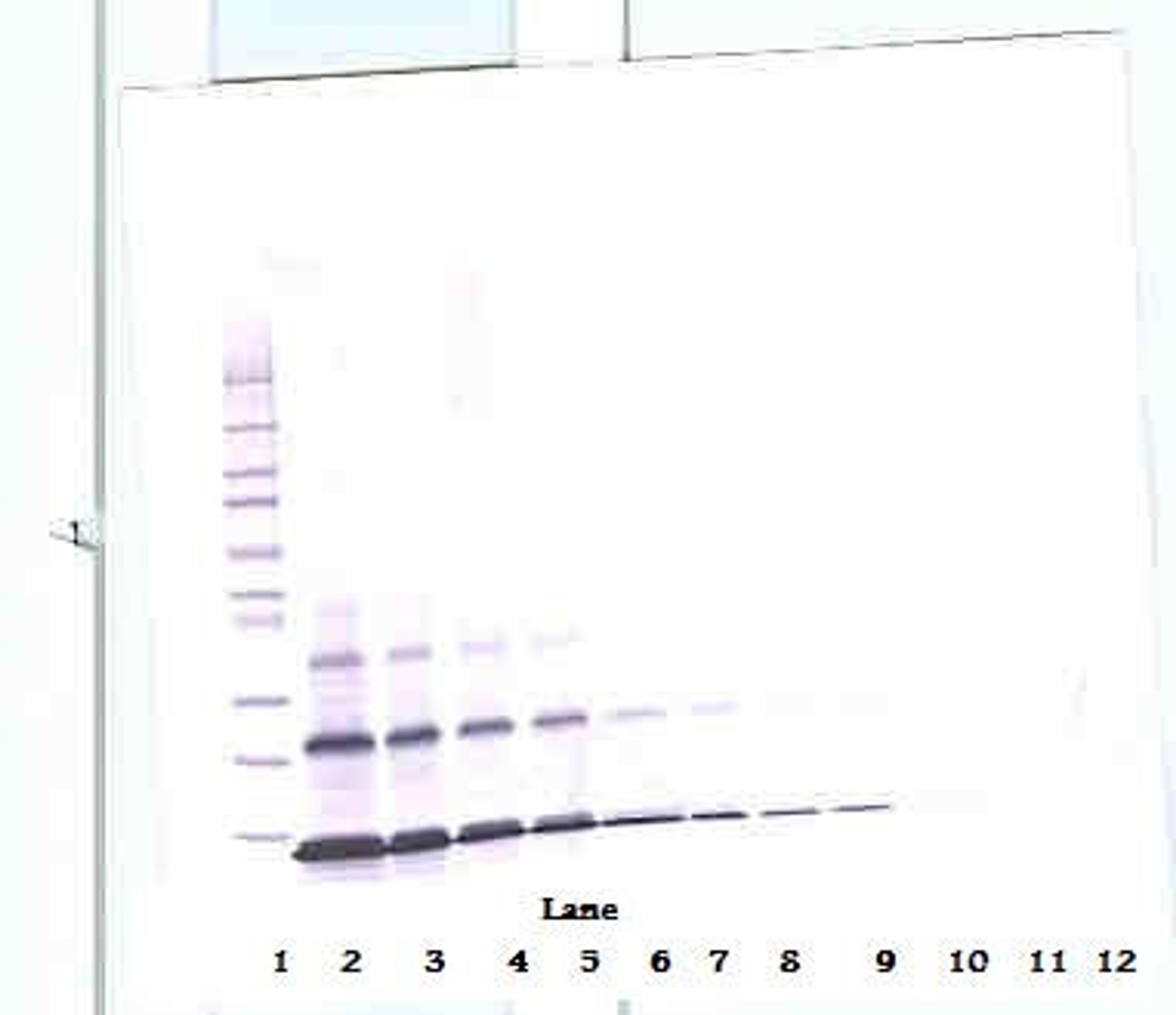 To detect hPTHrP by Western Blot analysis this antibody can be used at a concentration of 0.1 - 0.2 ug/ml. Used in conjunction with compatible secondary reagents the detection limit for recombinant hPTHrP is 1.5 - 3.0 ng/lane, under either reducing or non