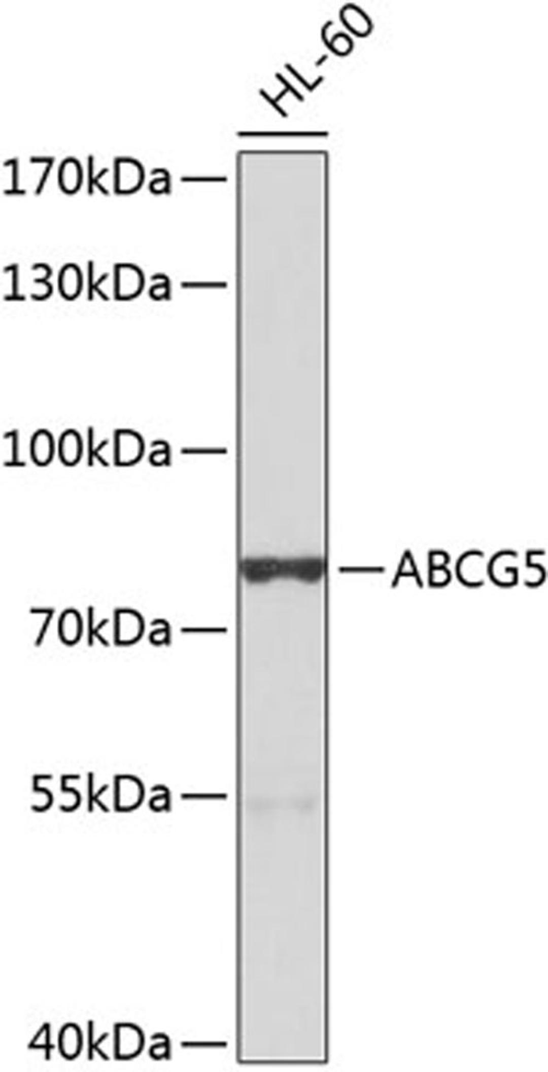 Western blot - ABCG5 antibody (A8589)