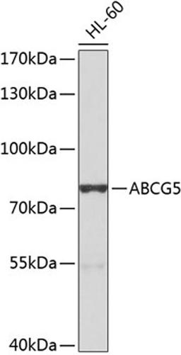 Western blot - ABCG5 antibody (A8589)