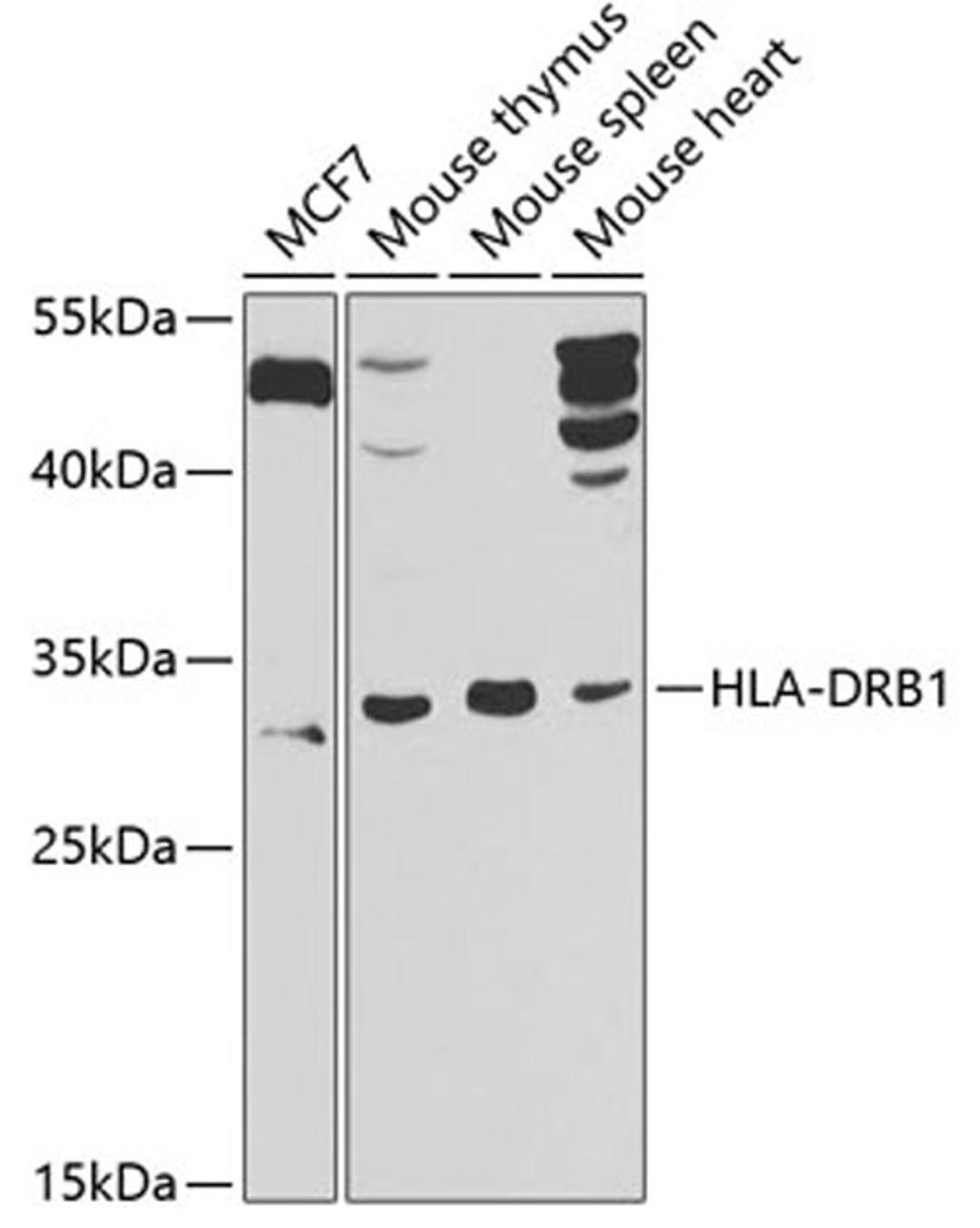 Western blot - HLA-DRB1 antibody (A7685)