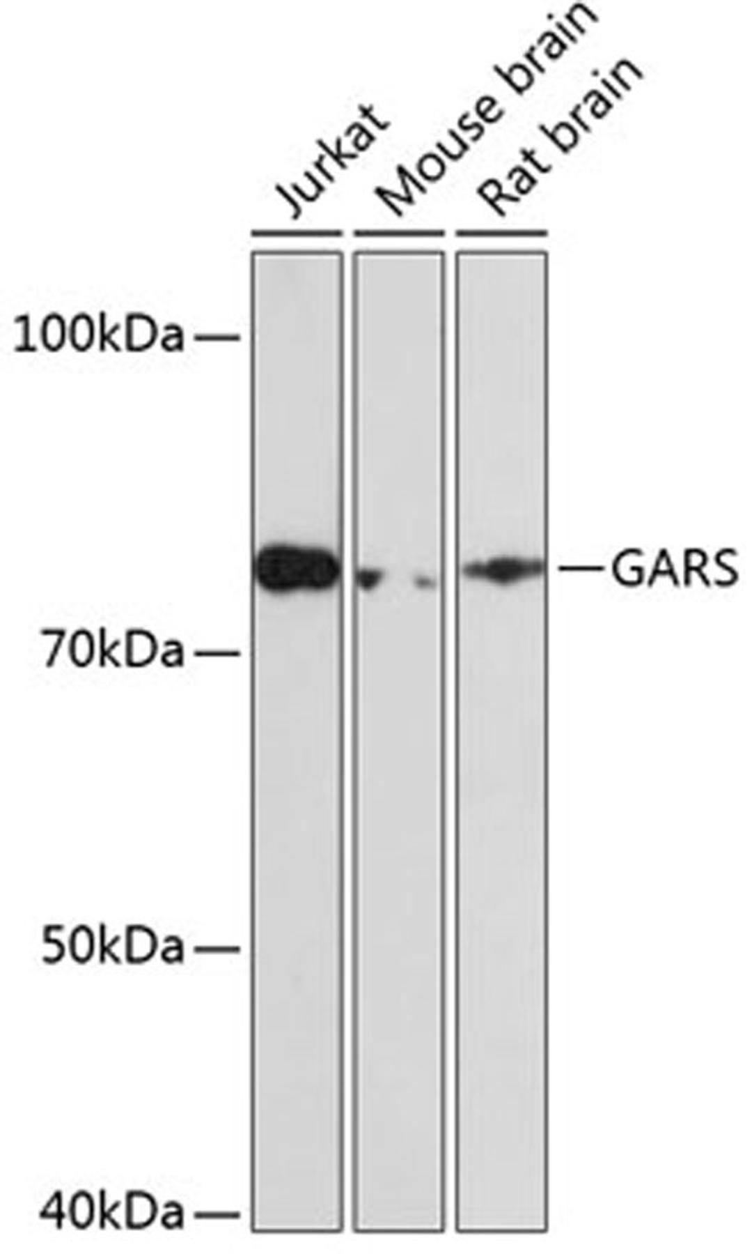 Western blot - GARS Rabbit mAb (A0651)