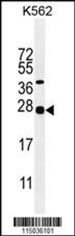 Western blot analysis in K562 cell line lysates (35ug/lane).