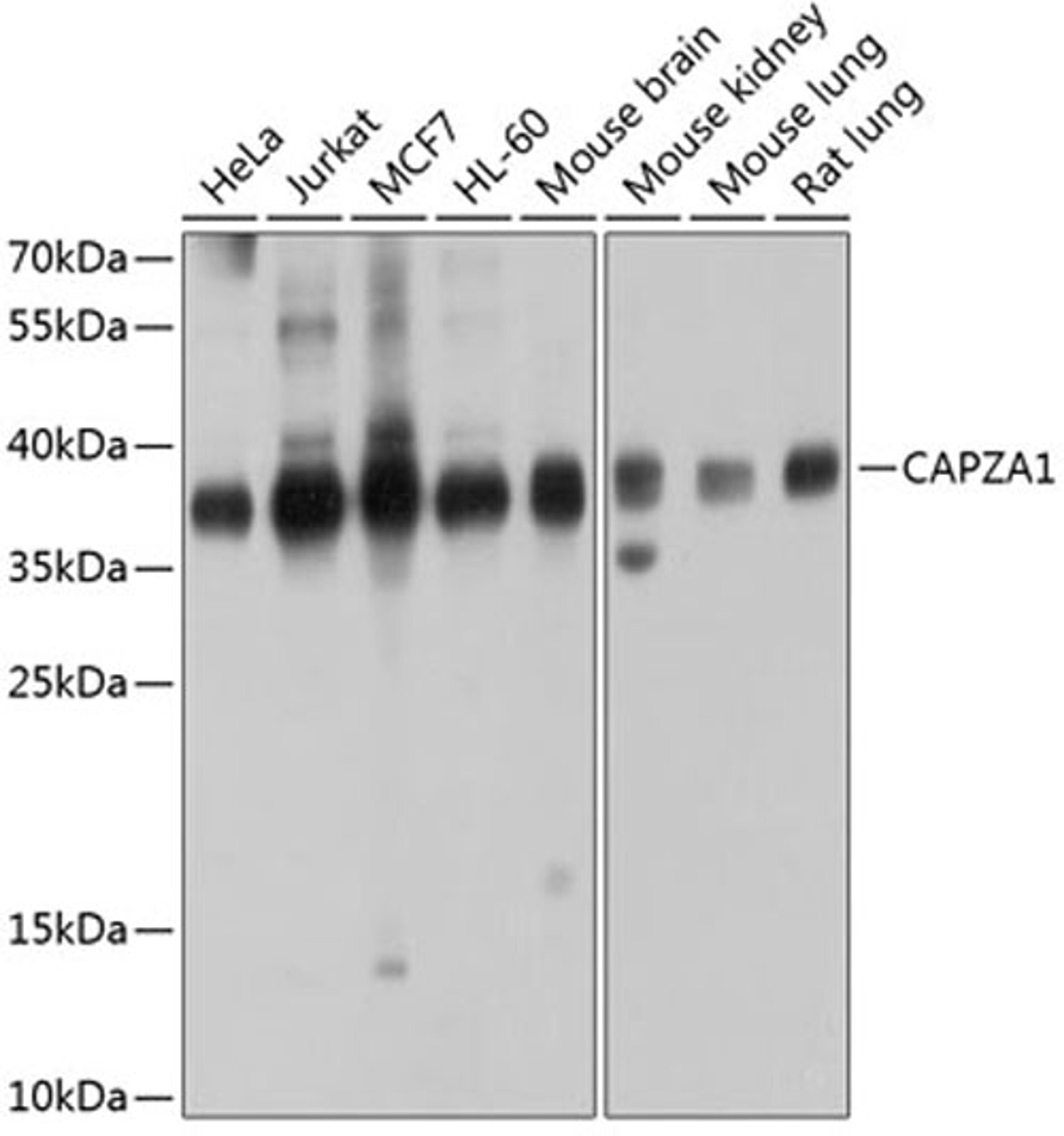 Western blot - CAPZA1 antibody (A3776)