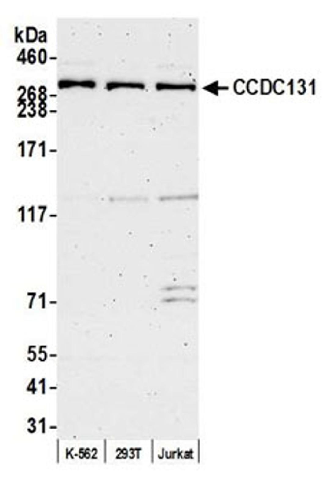 Detection of human CCDC131 by western blot.