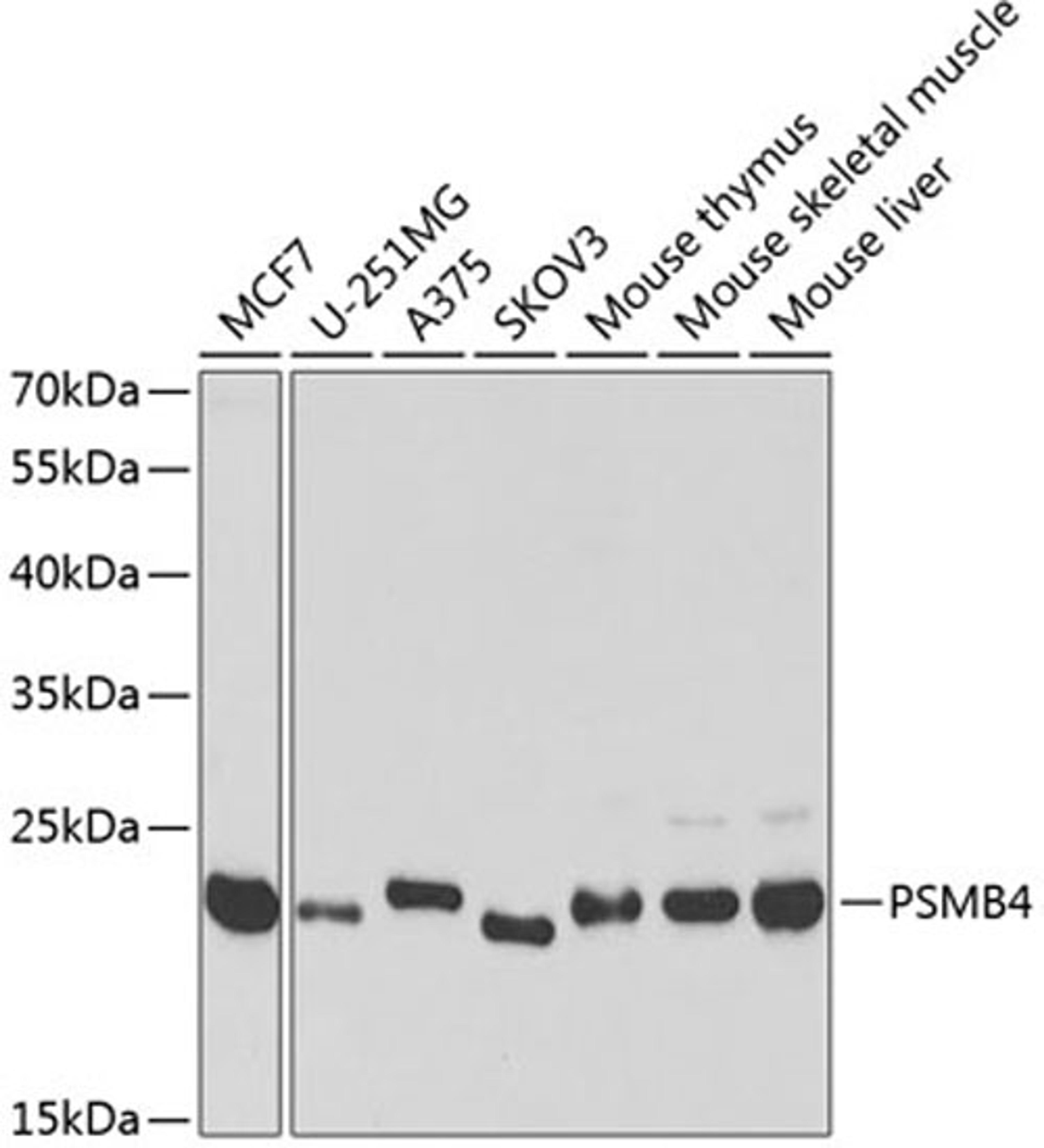 Western blot - PSMB4 antibody (A5697)