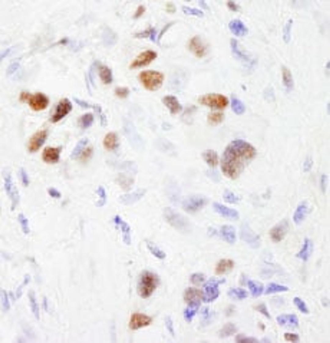 Detection of human SF3b145/SAP145 by immunohistochemistry.