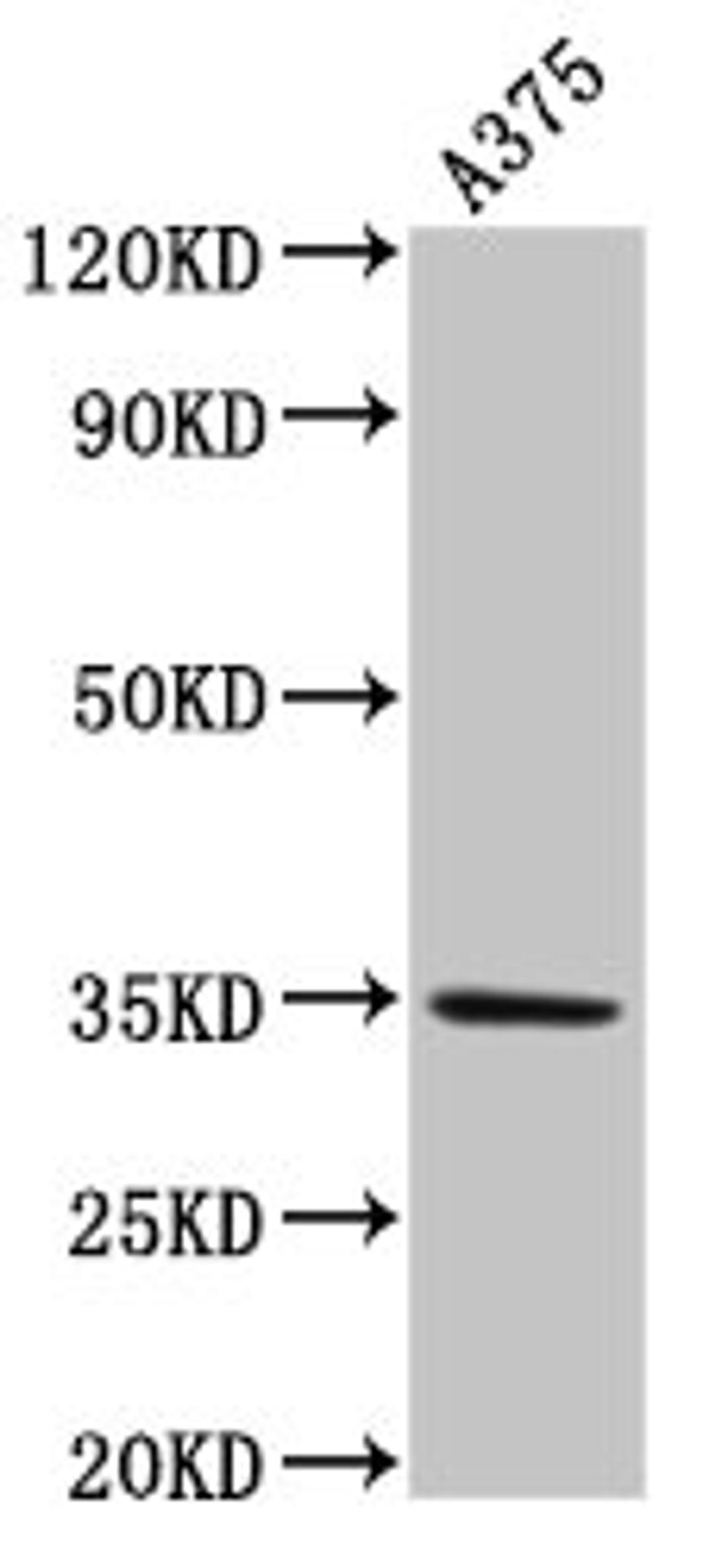 Western Blot. Positive WB detected in: A375 whole cell lysate. All lanes: MC1R antibody at 4µg/ml. Secondary. Goat polyclonal to rabbit IgG at 1/50000 dilution. Predicted band size: 35 kDa. Observed band size: 35 kDa