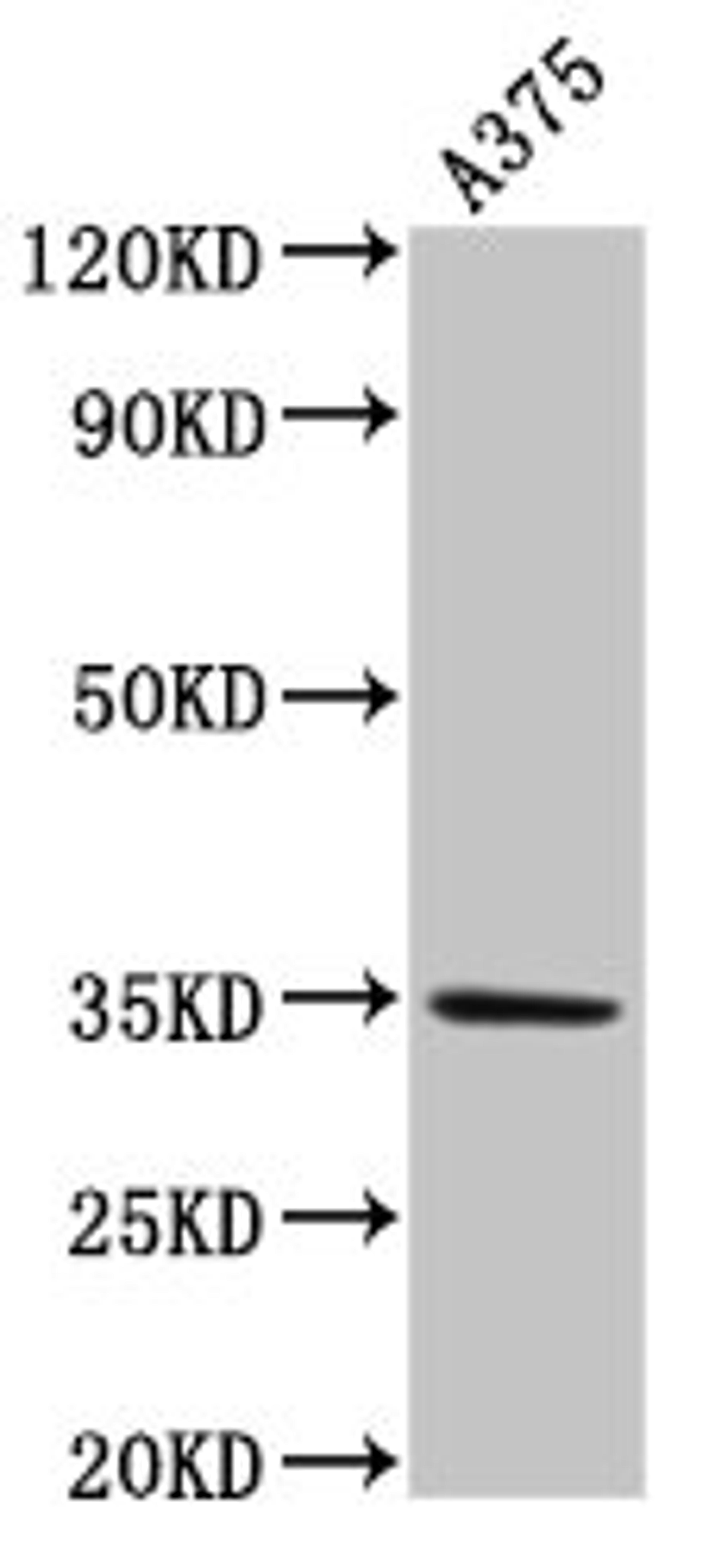 Western Blot. Positive WB detected in: A375 whole cell lysate. All lanes: MC1R antibody at 4µg/ml. Secondary. Goat polyclonal to rabbit IgG at 1/50000 dilution. Predicted band size: 35 kDa. Observed band size: 35 kDa
