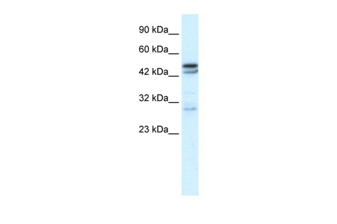 Antibody used in WB on Human Thymus at 0.1 ug/ml.