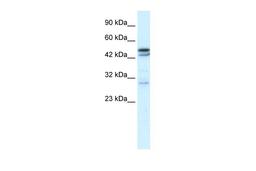 Antibody used in WB on Human Thymus at 0.1 ug/ml.