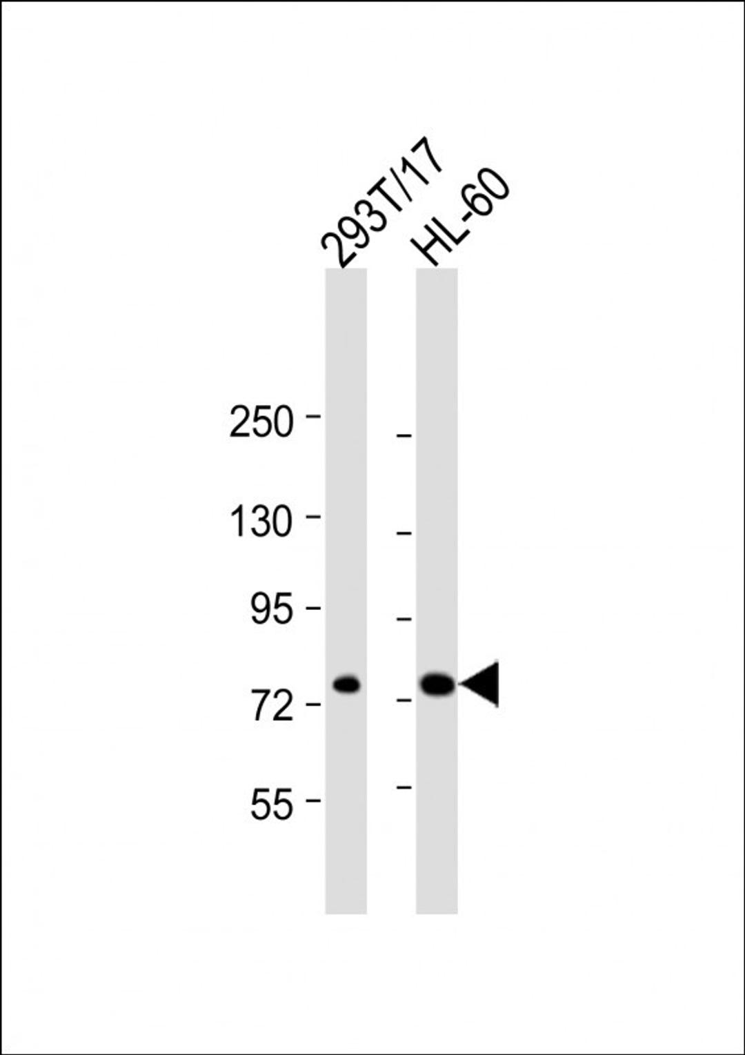 Western Blot at 1:2000 dilution Lane 1: 293T/17 whole cell lysate Lane 2: HL-60 whole cell lysate Lysates/proteins at 20 ug per lane.