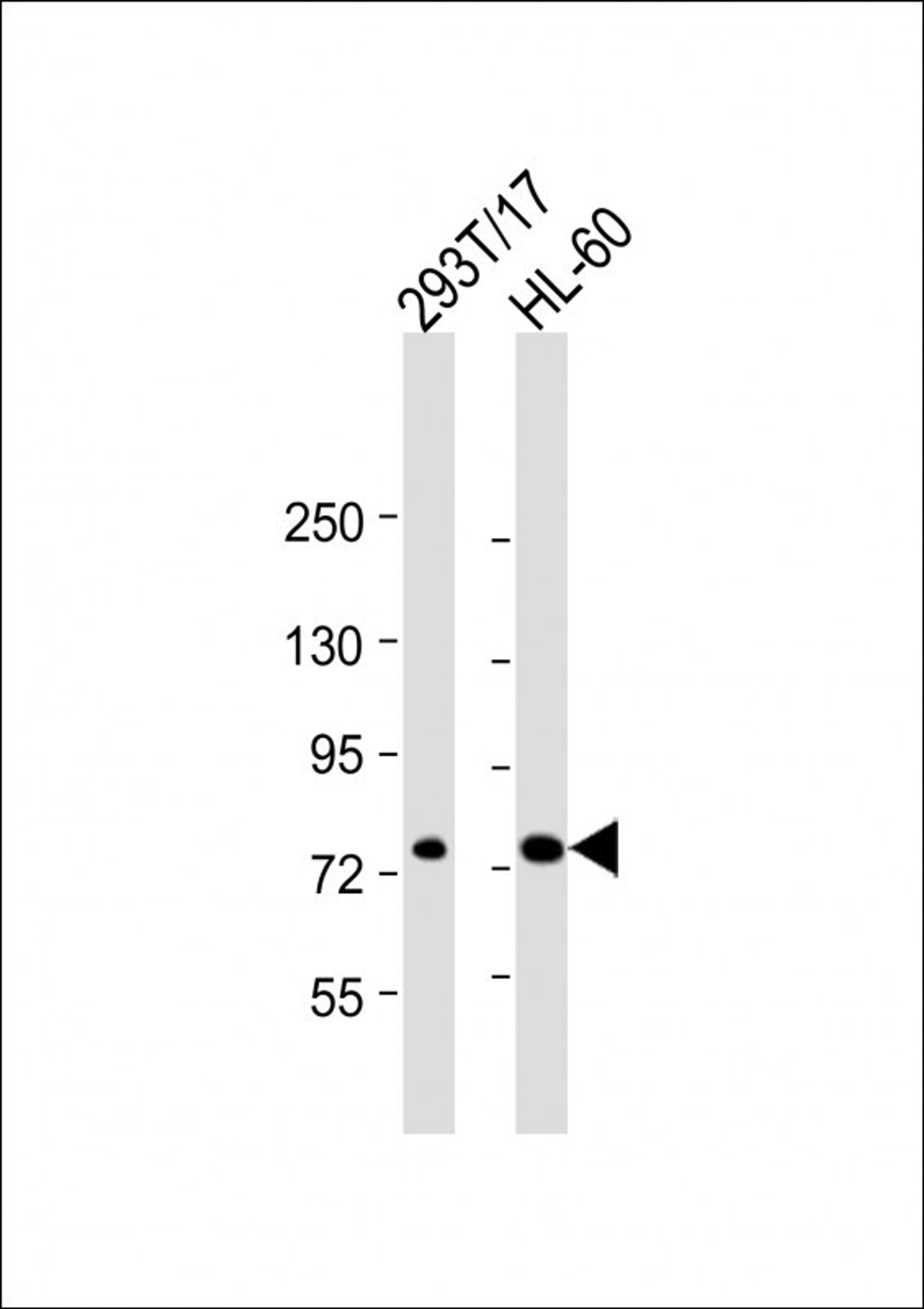 Western Blot at 1:2000 dilution Lane 1: 293T/17 whole cell lysate Lane 2: HL-60 whole cell lysate Lysates/proteins at 20 ug per lane.