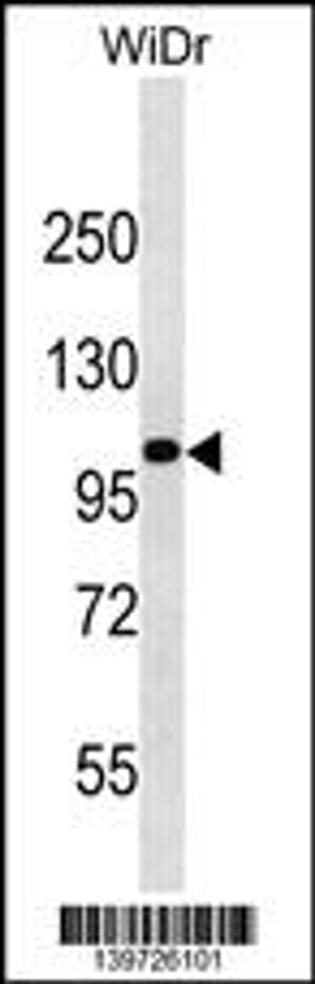 Western blot analysis in WiDr cell line lysates (35ug/lane).