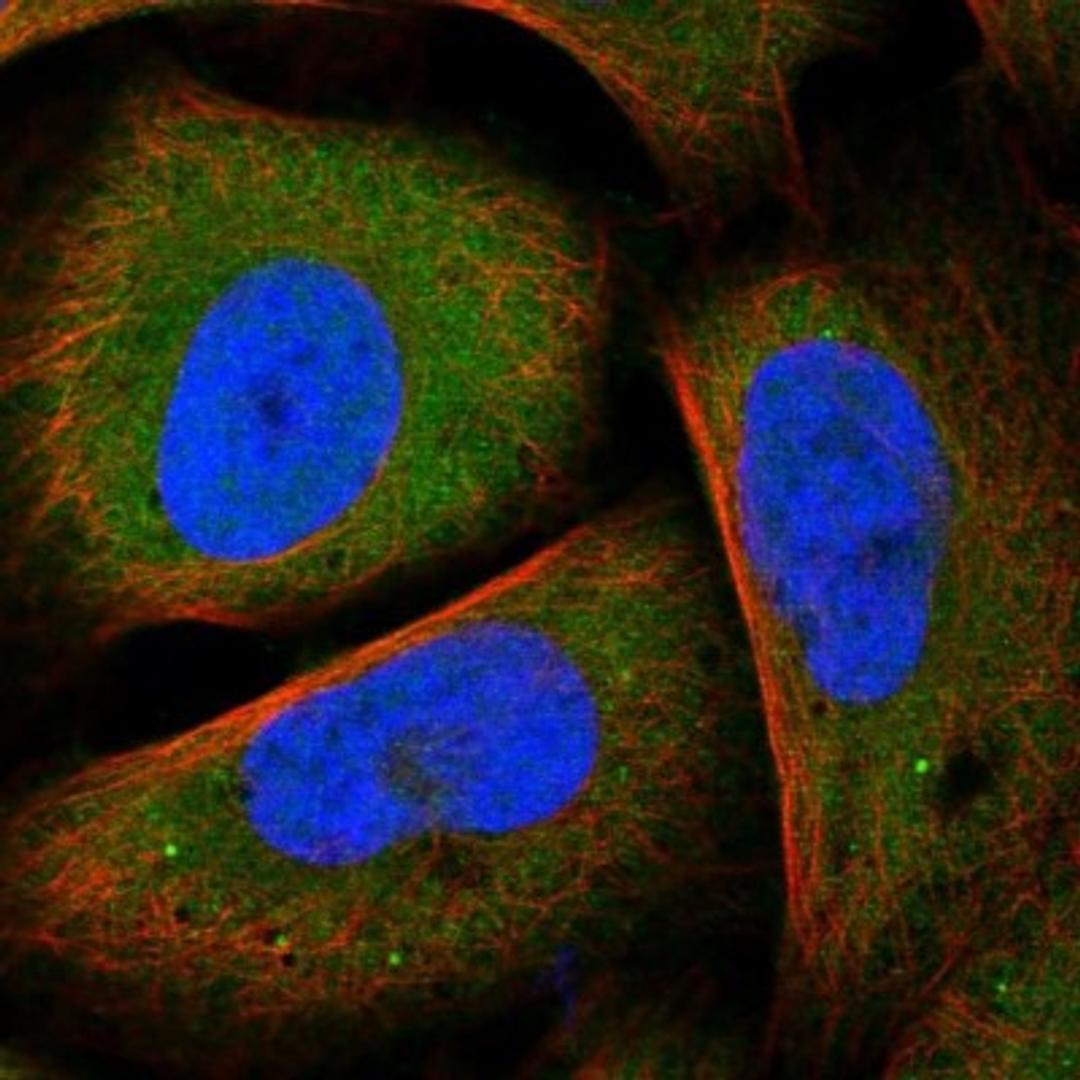 Immunocytochemistry/Immunofluorescence: SZRD1 Antibody [NBP1-85074] - Staining of human cell line U-2 OS shows positivity in nucleus but not nucleoli, cytoplasm & vesicles.