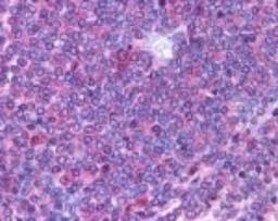 Immunohistochemistry-Paraffin: IL-23 R Antibody [NB600-1147] - Staining of IL-23 Receptor in Human periarterial lymphatic sheath lymphocytes (spleen) at 10 ug/ml. Hematoxylin-eosin counterstain.