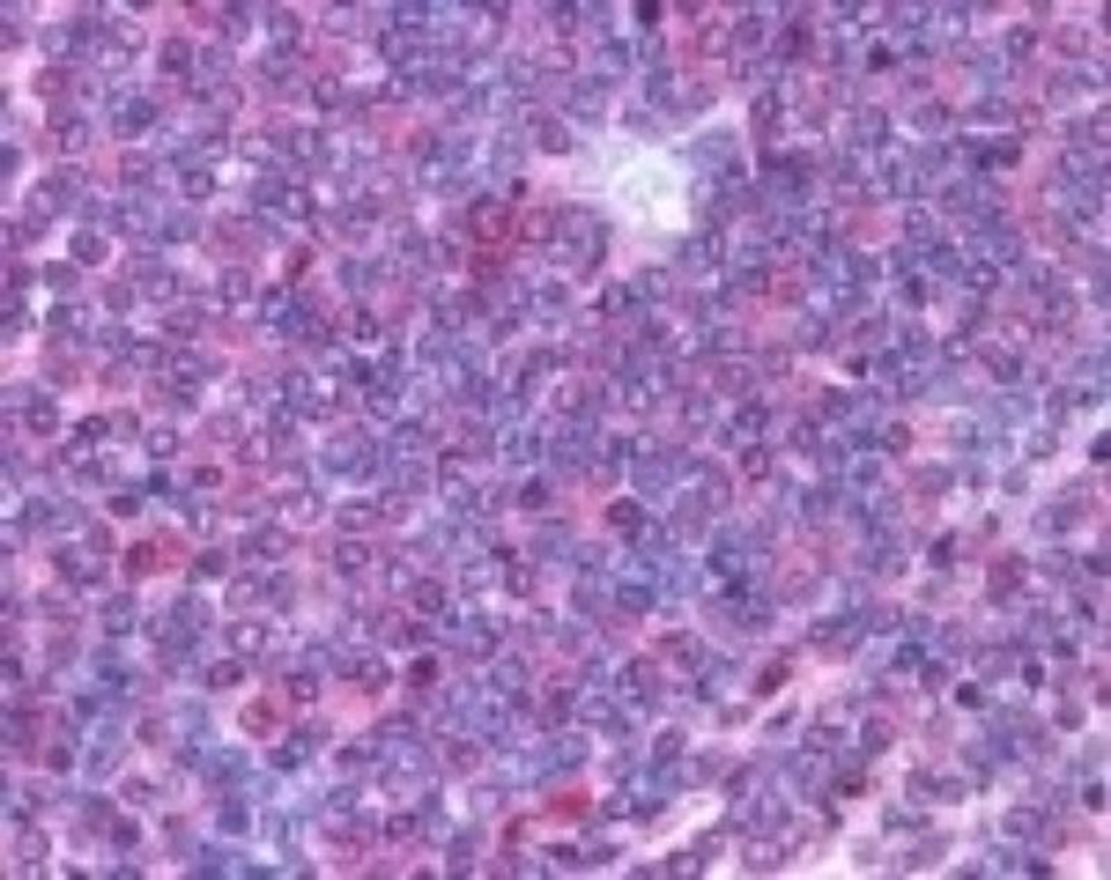 Immunohistochemistry-Paraffin: IL-23 R Antibody [NB600-1147] - Staining of IL-23 Receptor in Human periarterial lymphatic sheath lymphocytes (spleen) at 10 ug/ml. Hematoxylin-eosin counterstain.