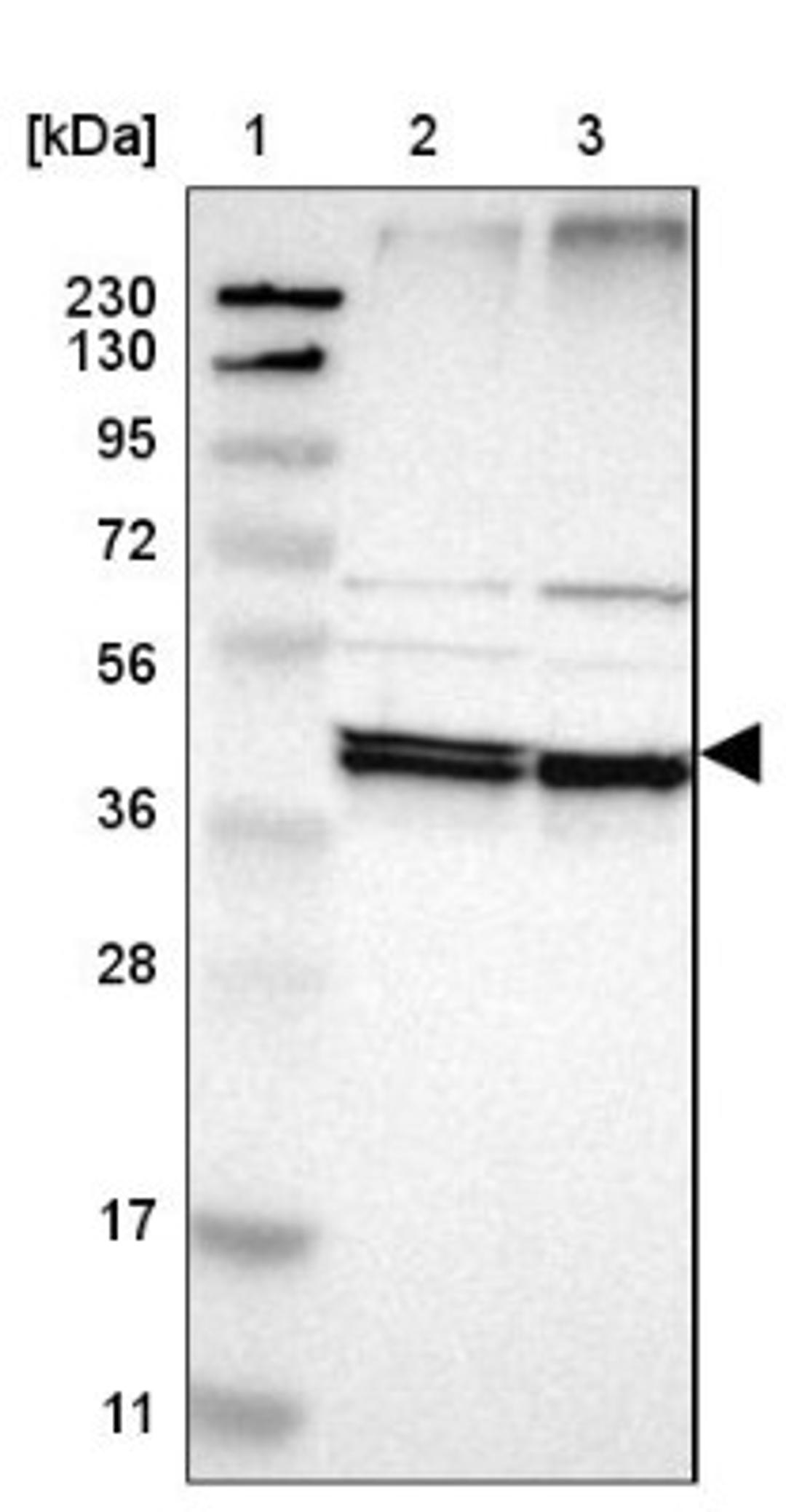 Western Blot: Ancient ubiquitous protein 1 Antibody [NBP1-85785] - Lane 1: Marker [kDa] 230, 130, 95, 72, 56, 36, 28, 17, 11<br/>Lane 2: Human cell line RT-4<br/>Lane 3: Human cell line U-251MG sp