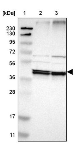 Western Blot: Ancient ubiquitous protein 1 Antibody [NBP1-85785] - Lane 1: Marker [kDa] 230, 130, 95, 72, 56, 36, 28, 17, 11<br/>Lane 2: Human cell line RT-4<br/>Lane 3: Human cell line U-251MG sp