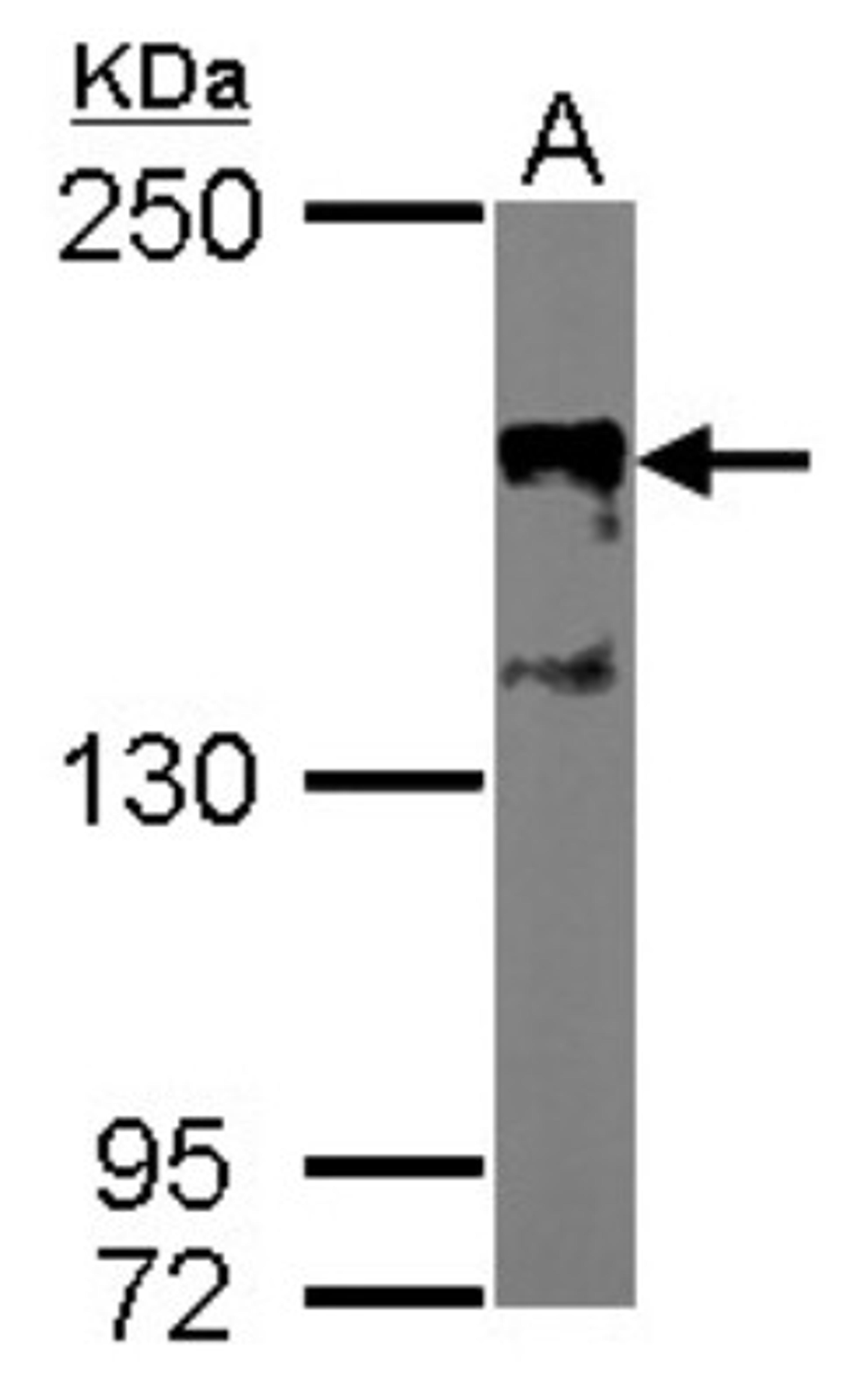 Western Blot: SRC1 Antibody (1135/H4) [NB200-310] - Sample (50 ug of whole cell lysate) A: Mouse brain 5% SDS PAGE, antibody diluted at 1:2000.