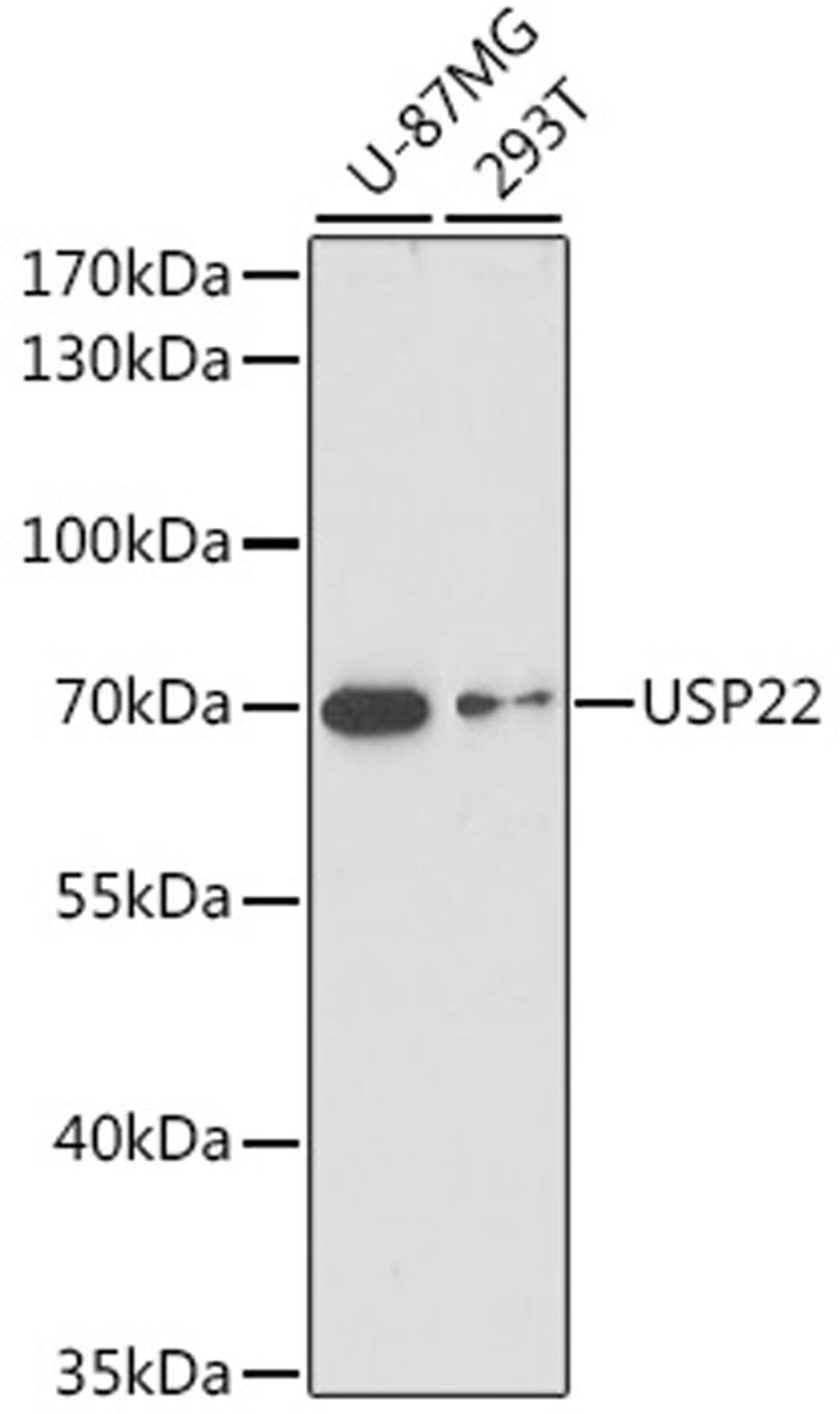 Western blot - USP22 antibody (A16297)