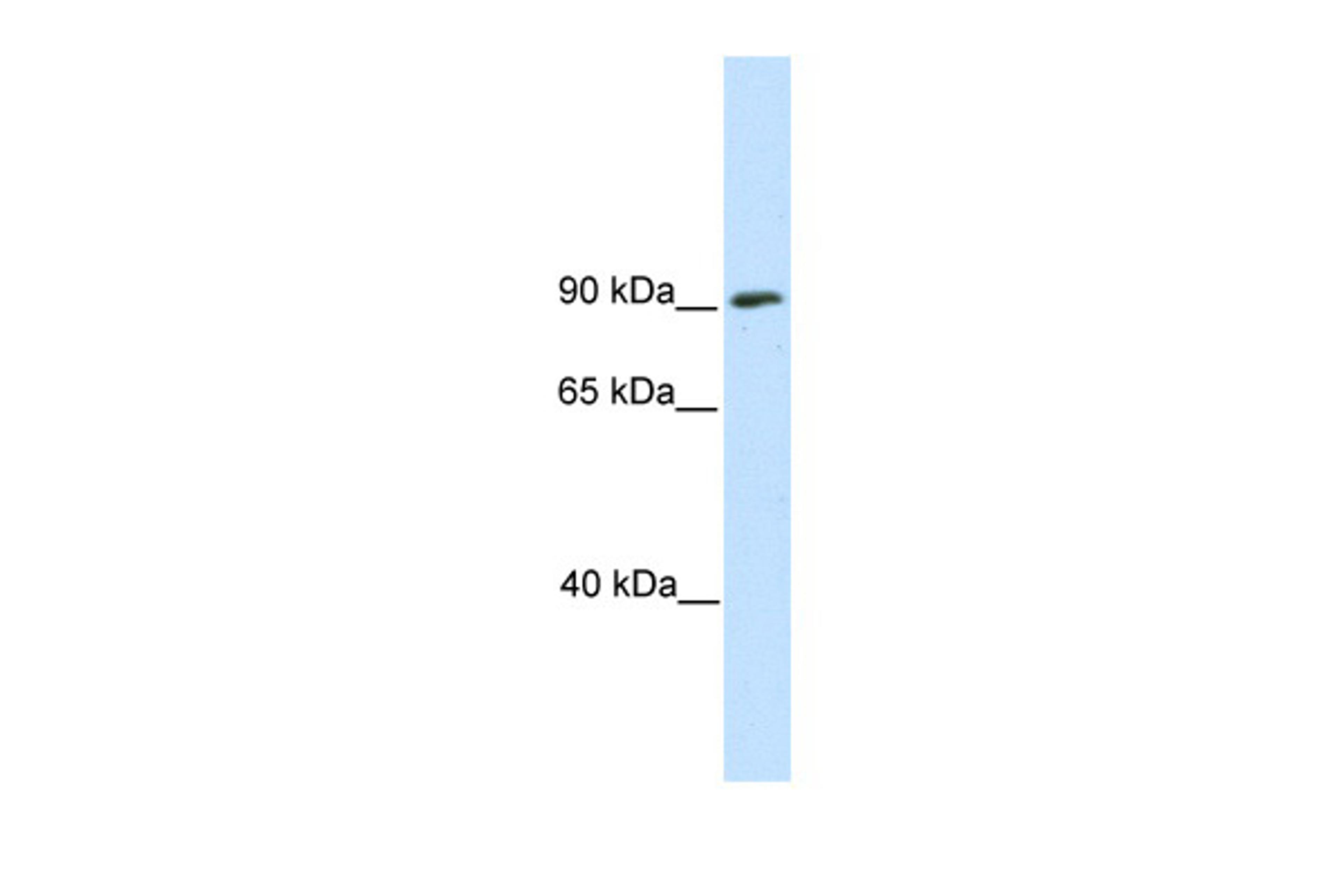 Antibody used in WB on Mouse SP2/0 at 0.2-1 ug/ml.