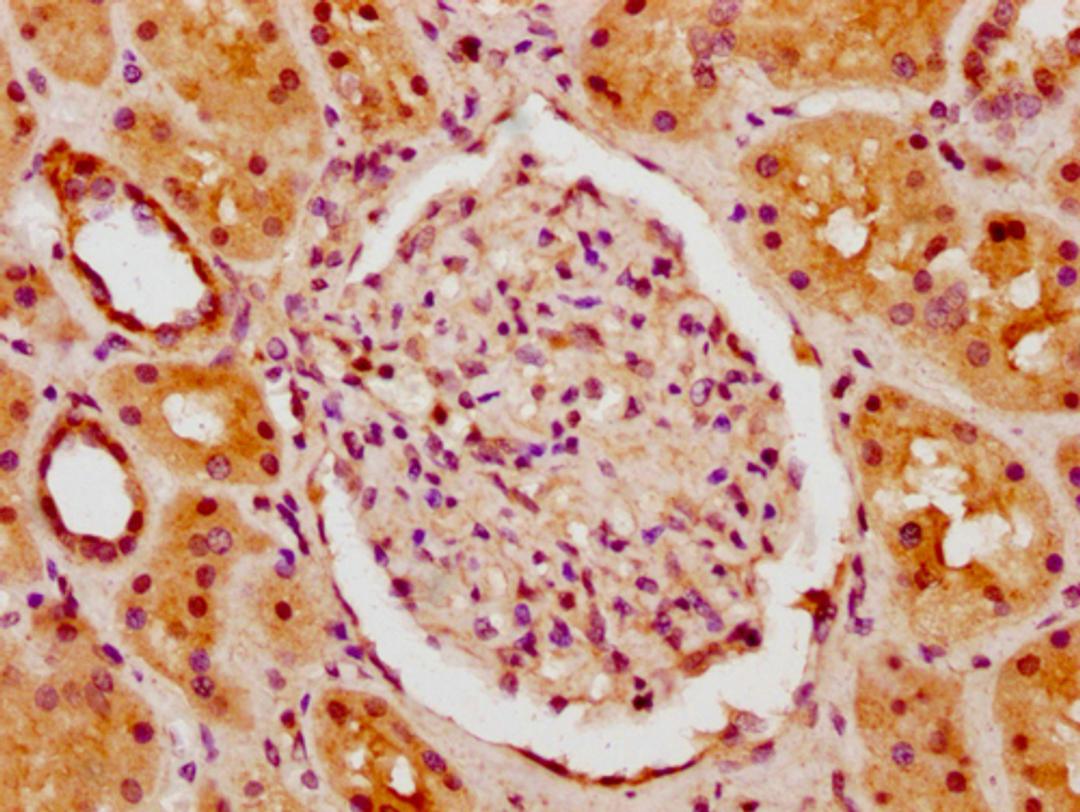 IHC image of CSB-PA010378PA62nhibHU diluted at 1:10 and staining in paraffin-embedded human kidney tissue performed on a Leica BondTM system. After dewaxing and hydration, antigen retrieval was mediated by high pressure in a citrate buffer (pH 6.0). Section was blocked with 10% normal goat serum 30min at RT. Then primary antibody (1% BSA) was incubated at 4°C overnight. The primary is detected by a biotinylated secondary antibody and visualized using an HRP conjugated SP system.